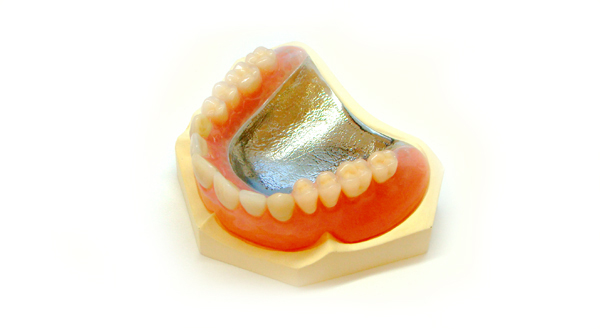金属の総入れ歯は薄くできます・麻布十番の歯科医院