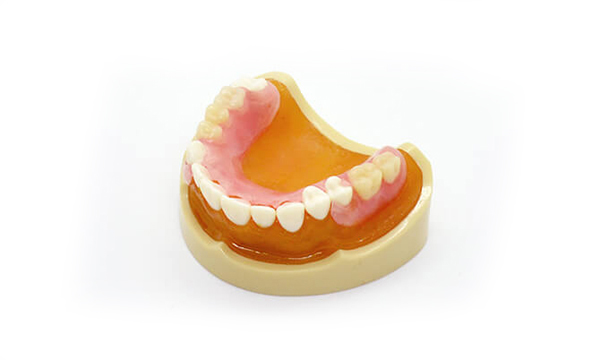 フレキシブル義歯・ノンクラスプデンチャーの入れ歯