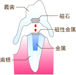 ꎕ𐢊Eꋭ͂ȃlIW[΂ŌŒE`斃z\